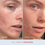 First Aid Beauty - Ultra Repair Cream, Intense Hydration Whipped Colloidal Oatmeal, Clinically Proven to Strengthen Skin Barrier in 7 Days & Helps Relieve Eczema, Luxury Moisturizer, 6 oz + Bonus, 2ct