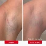 First Aid Beauty - Ingrown Hair Ps with BHA + AHA - Aftershave Treatment Ps to Help Prevent Razor Bumps for Men & Women - Exfoliate Underarms & Bikini Area - Compostable for Daily Use - 28 Ps
